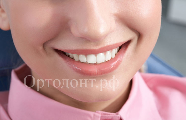 исправление зубов в домашних условиях