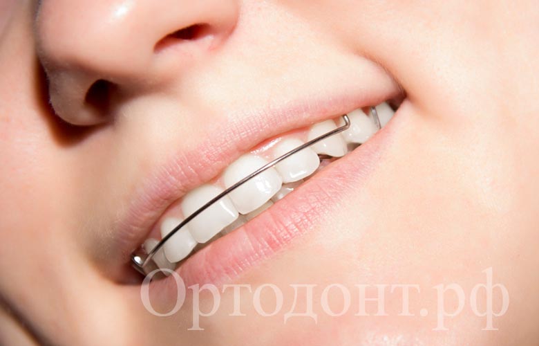ортодонтия фото