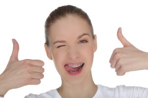 поставить брекеты